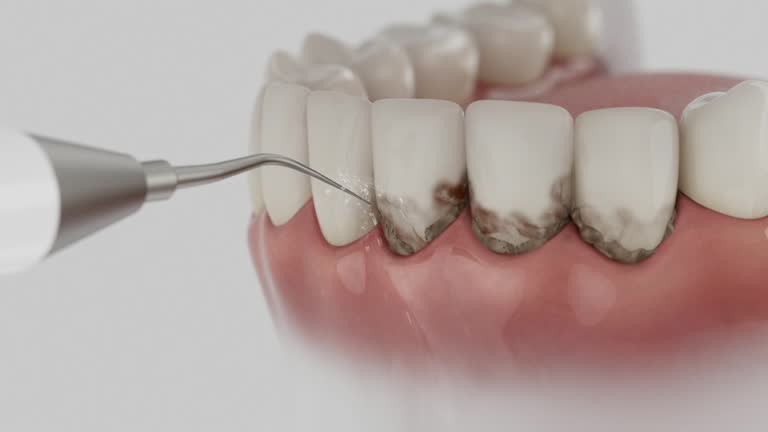 Reliable Dental contractor in West Ocean City, MD by Dentist Open Now